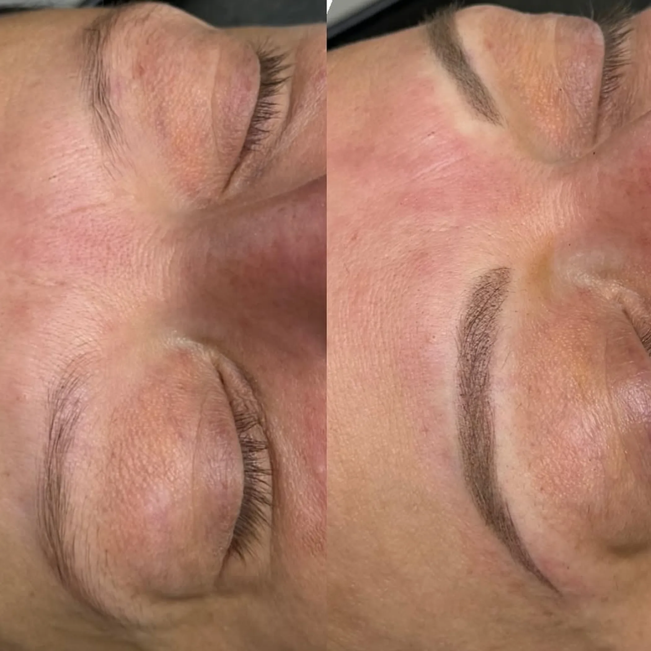 eyebrow tattoo scabbing and flaking stage